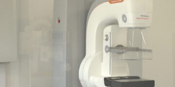 Mobilni digitalni mamograf u Zaječaru od 6. jula