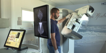 Odlično interesovanje žena u Zaječaru za pregled na mobilnom mamografu (VIDEO)